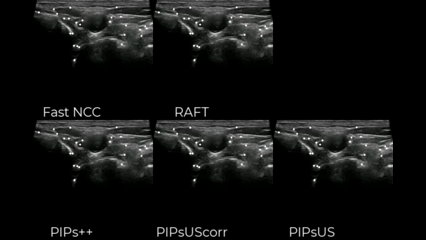 Tracking-any-point model for ultrasound