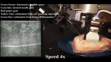 Dual-path bending needle tracking