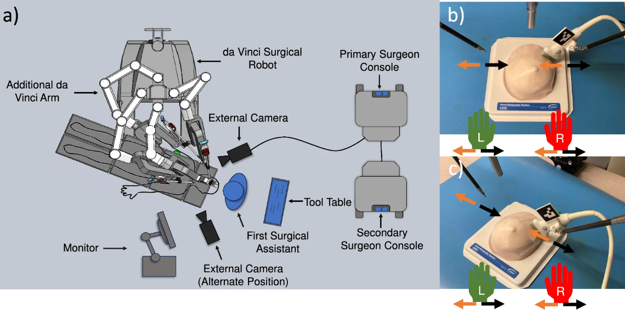 Robot-assisted US scan for TORS