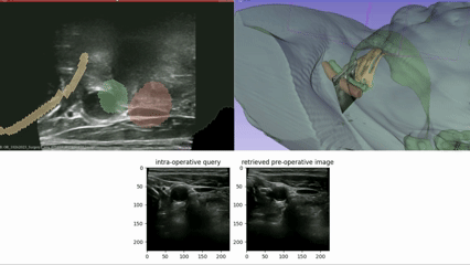 Self-supervised US view retrieval